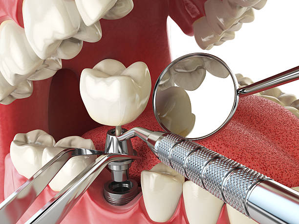 Best Emergency Treatment for Oral Infections in Chincoteague, VA